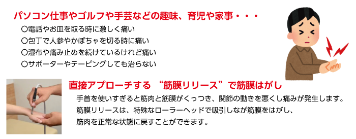 手首の痛み